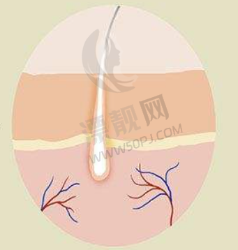 头发种植