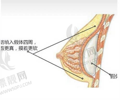 北京嘉禾整形医院赵希军做傲诺拉星耀假体隆胸要多少钱？傲诺拉星耀假体隆胸价格在 48880元-88880元 ！