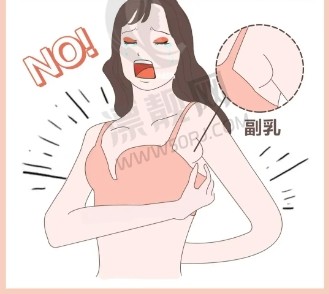 去副乳失败修复