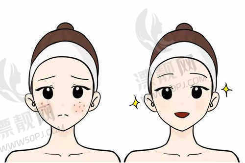 成都致心医疗美容医院埋线双眼皮技术怎么样好不好？