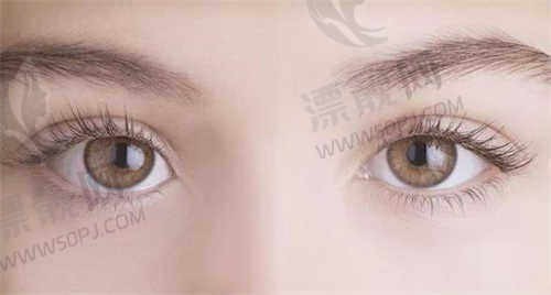 芜湖一秒医疗美容医院特色技术：韩风三点双眼皮手术
