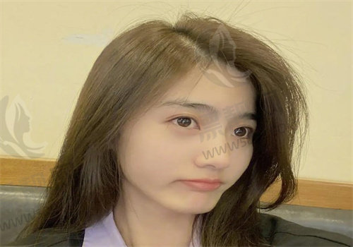 重庆做鼻子<span style=