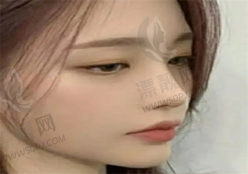 重庆做鼻子<span style=