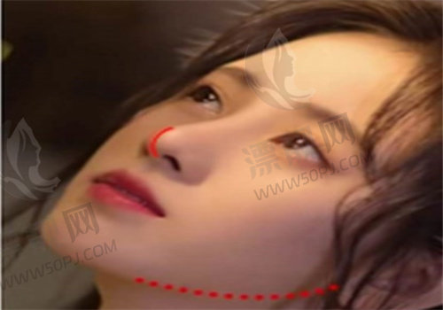 重庆做鼻子<span style=