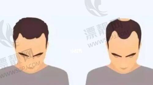 深圳皇佳亿美医疗美容是正规医院吗？技术口碑双优打造理想医美体验！