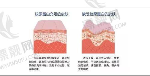 丽水中心医院祛斑点痣价格表最新曝光！揭秘激光祛斑与点痣效果及丽水医美优选！