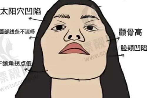 北京地区价格解析:贵得有理的
