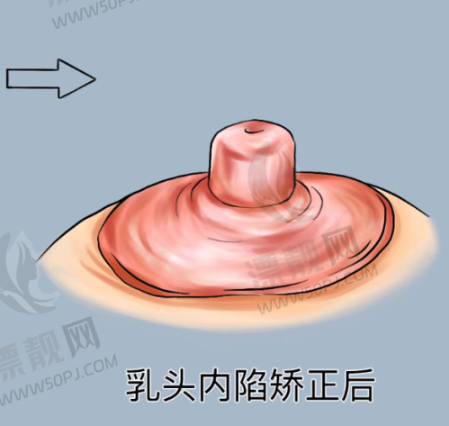 10. 西安华仁医院毛发科
