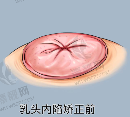 选择深圳皇佳亿美医疗美容的理由