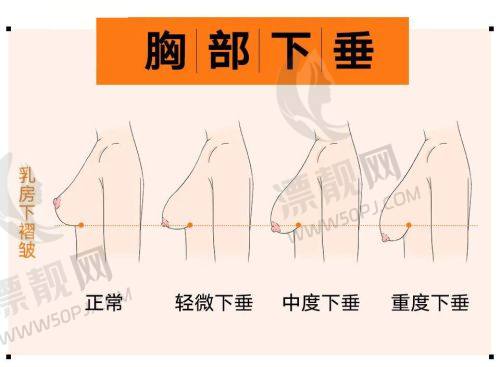 术后管理细致如保姆，3个月维稳曲线