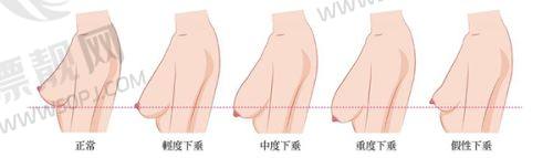价格透明，选择不难——不同修复项目参考费用表