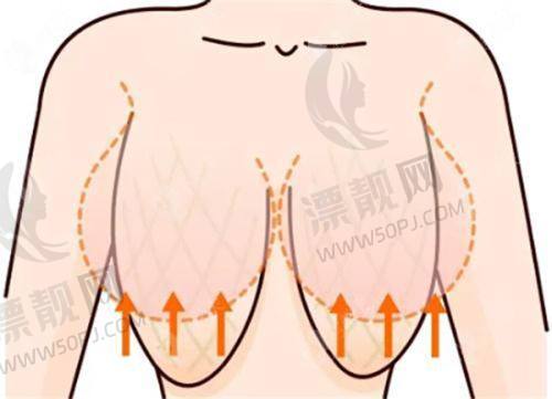 为何大连爱德丽格成为二次修复热门之选？