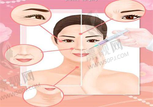 徐州做双眼皮哪家医院最专业最好？徐州医科大学附院、徐州华美、徐州莱美俪格排名靠前！
