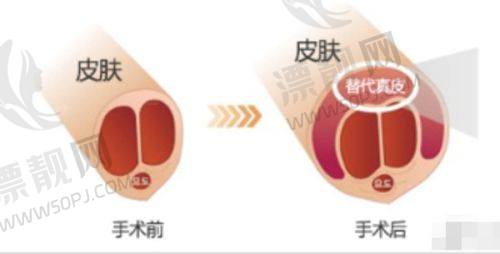关于私密激光嫩红价格的常见疑问解答