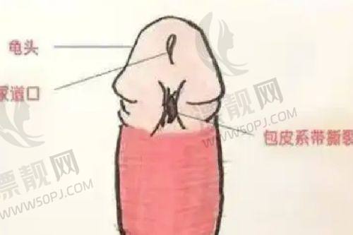 私密激光嫩红的成效和维持时长