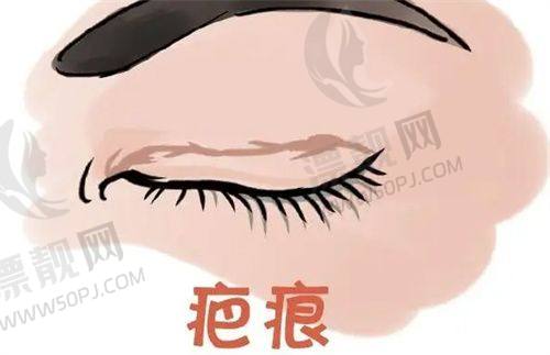 芭比针与比芭美玻尿酸产品差异及独特优势