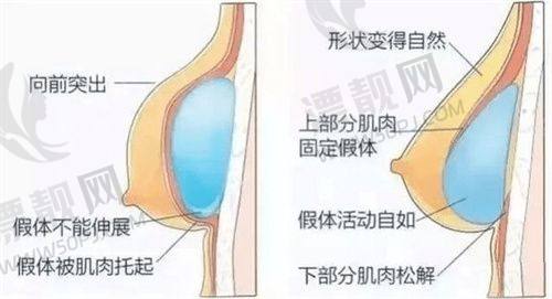 临床成效矩阵