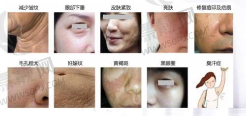 适合人群:看看你是不是那个对的人
