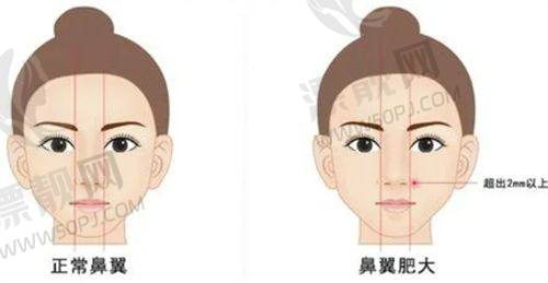 5. 泉州丰泽美莱华美整形医院