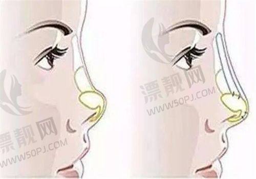 杭州天鑫医疗美容医院怎么样？正规性、口碑全揭秘，为你开启变美新体验！