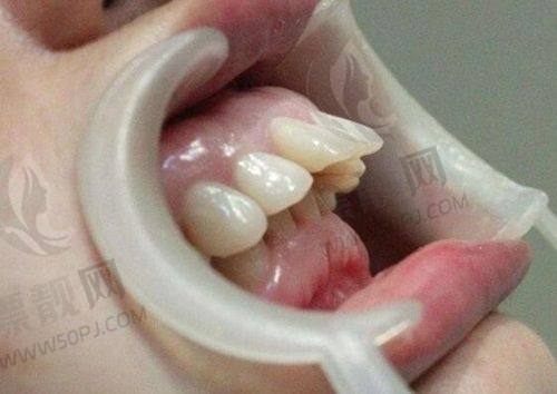 擅长项目:种植、美学修复与牙周治疗三架马车并驾齐驱