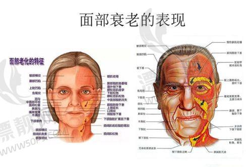 TOP3:中南大学湘雅医院整形科 - 雷少榕医生
