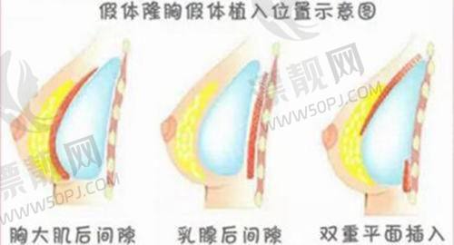 见效时间和成效累积