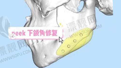 韩国皮肤管理排行榜名单公布！Elev、金泰拉、德希尔皮肤科领衔抗衰榜单