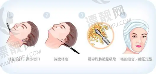 治疗间隔时间和疗程时长