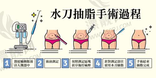 美波婷丰胸的未来发展趋势