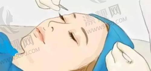 长沙双眼皮手术的市场现状