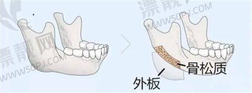 海绵体注射有什么作用和功效、副作用，一次能管多久？费用及临床优势大揭秘