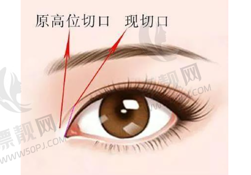 患者真实反馈:成效看得见