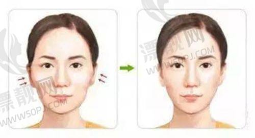 顾客实例分享:见证真实的美丽蜕变