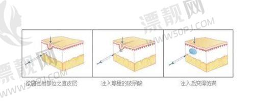 突出的技术优势,打造自然灵动的双眸