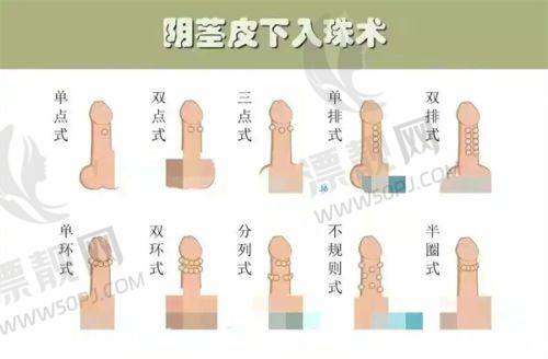 昆明吴氏嘉美美容医院眼部整形项目详情