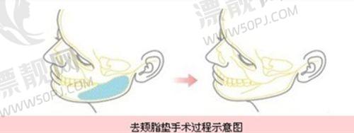 三、选择建议