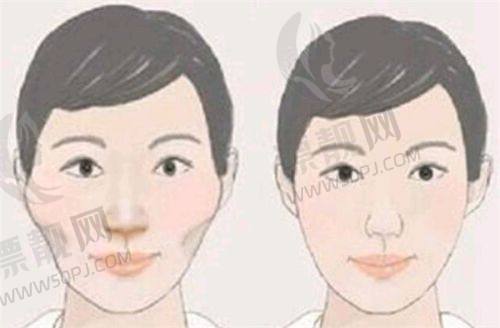 五、皮肤管理项目性价比分析