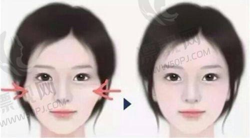 七、如何选择适合自己的医美项目