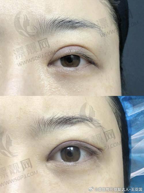9. 胡征宇｜南京壹加壹整形美容医院｜中青年商务女性优选