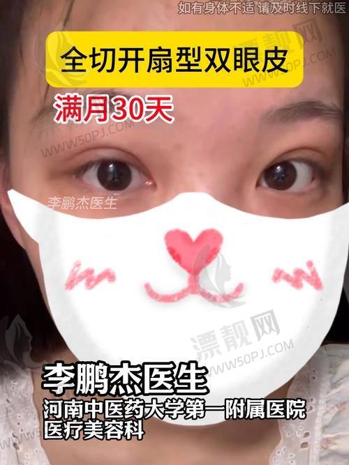 10. 陈曼丽｜南京禾丽医疗美容｜“软萌感”代表局部重塑派