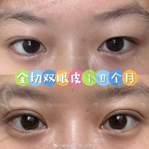 3. 吴照芹｜南京韩辰医疗美容医院｜韩式自然流派代表医生