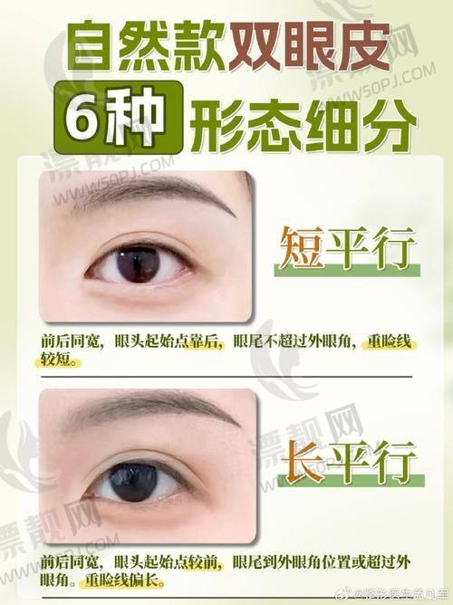 1. 汪树杰｜南京艺星医疗美容｜闭眼无痕术新宠
