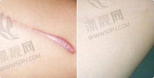 结语:术后管理决定疗效的“后半程”