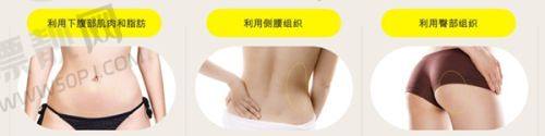 朱京成全切双眼皮怎么样？呼市京美院长芭比眼案例大公开