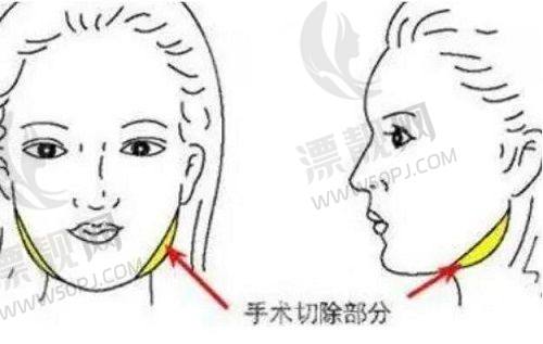 三、避坑指南