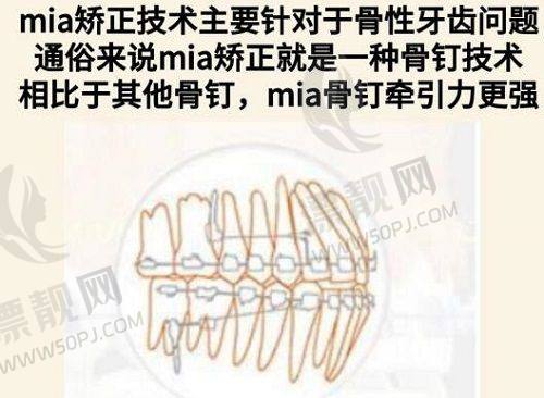 北京协和王阳抽脂手术费用一览表：揭秘2-5万高性价比塑形方案，术后效果惊艳