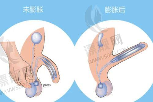 三、选择医院的维度分析