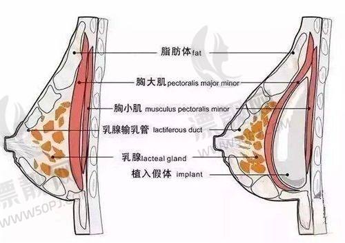 武汉哪家医院有菲塑美减肥针？武汉五洲、协和整形、艺星排名靠前别错过！