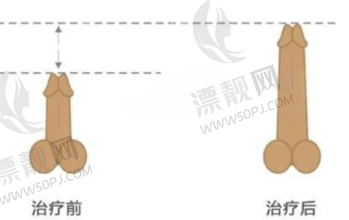 南宁华美整形美容医院拉皮手术的正规性揭秘